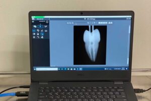 Endodontics-Hands-on-training-27