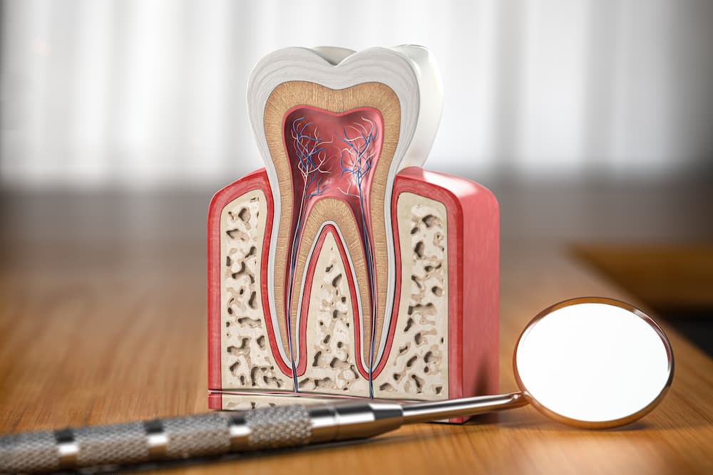 Root Canal Treatment