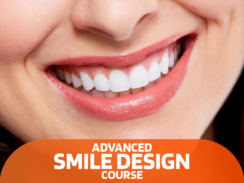 Smile Design Featured Image Advanced Smile Design Course